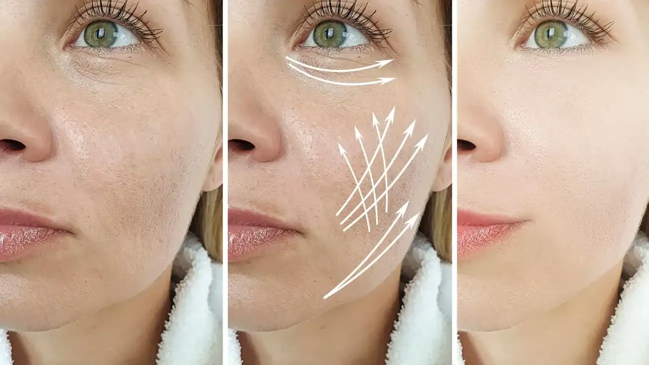 Can One Treatment Really Tackle More Than One Skin Concern Isle of Isla?