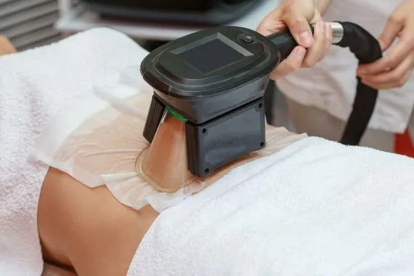 Image of person having fat freezing treatment to help weight gain Isle of Isla