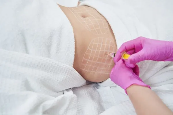 image of fat dissolving injections on love handles to help combat weight gain Isle of Isla