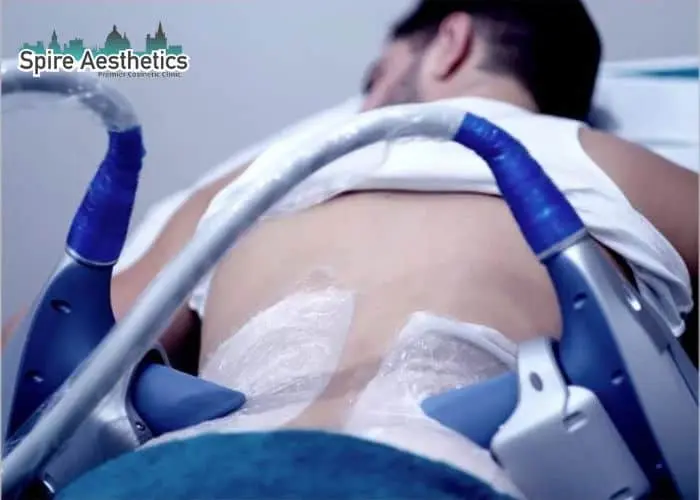 Man having fat freezing treatment done on love handles before a competitions Isle of Isla to create a sculpted look.