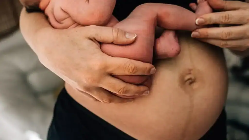 Why Is My Stomach Still Big After Pregnancy Isle of Isla?